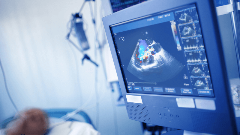 Fetal Echocardiography (Fetal Echo)