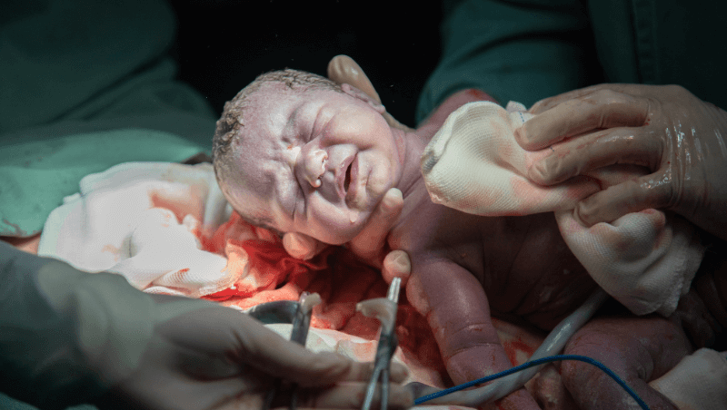 cesarean-delivery-in-bhugaon-bavdhan