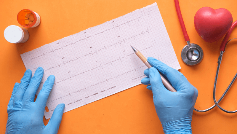 Electrocardiography (ECG) 
