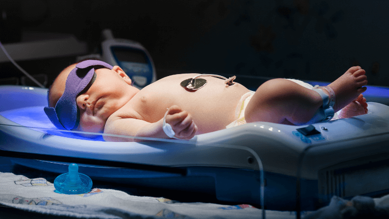 Jaundice Treatment 