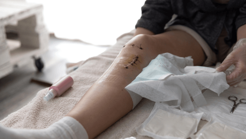 retrograde-intrarenal-surgery-in-bhugaon-bavdhan